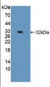 网蛋白(PLEC）多克隆抗体