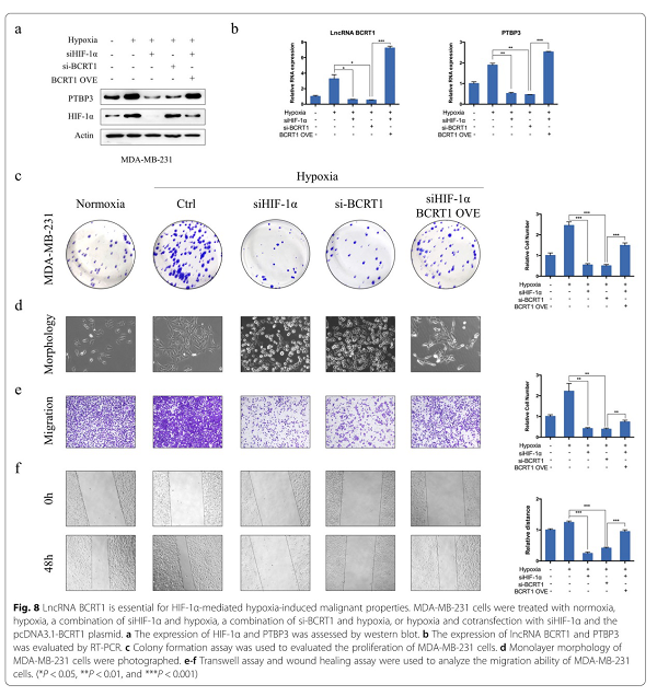 LncRNA BCRT1通过靶向miR-1303/PTBP3来促进乳腺癌的进展