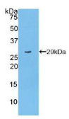 多聚ADP核糖聚合酶(PARP）多克隆抗体