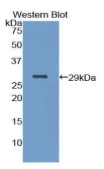 角蛋白18(KRT18）多克隆抗体