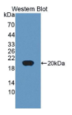 腱蛋白样蛋白2(CHRDL2）多克隆抗体