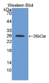 溶质载体家族30成员6(SLC30A6）多克隆抗体