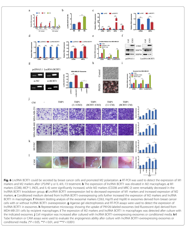 LncRNA BCRT1通过靶向miR-1303/PTBP3来促进乳腺癌的进展