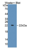 PHD指蛋白8(PHF8）多克隆抗体