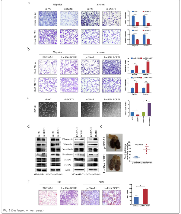 LncRNA BCRT1通过靶向miR-1303/PTBP3来促进乳腺癌的进展