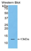 S100钙结合蛋白A10(S100A10）多克隆抗体