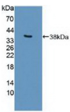 E1A结合蛋白P300(EP300）多克隆抗体