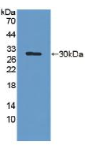 糖蛋白A33(GPA33）多克隆抗体