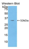 p21蛋白激活激酶4(PAK4）多克隆抗体