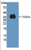 细胞色素b-245β肽(CYBβ）多克隆抗体