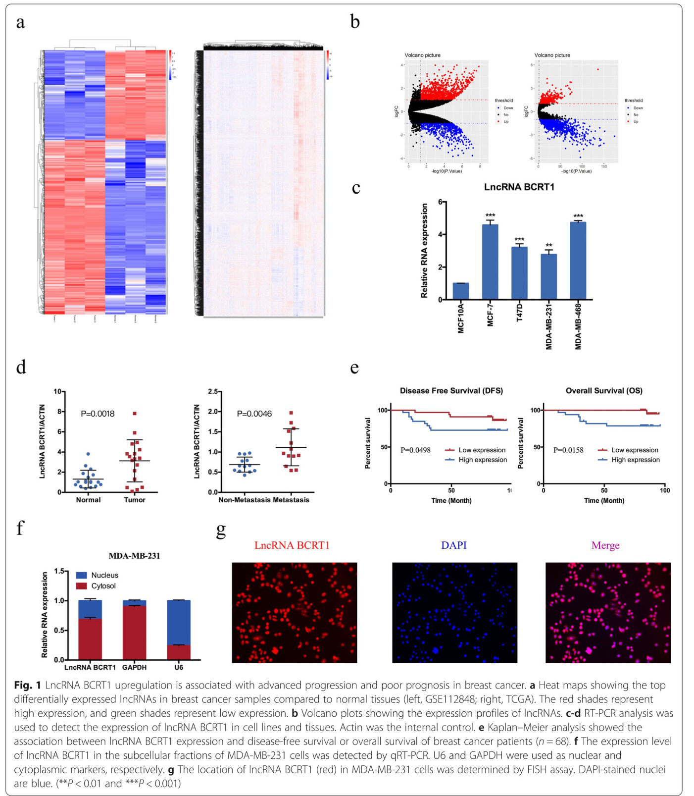 LncRNA BCRT1通过靶向miR-1303/PTBP3来促进乳腺癌的进展