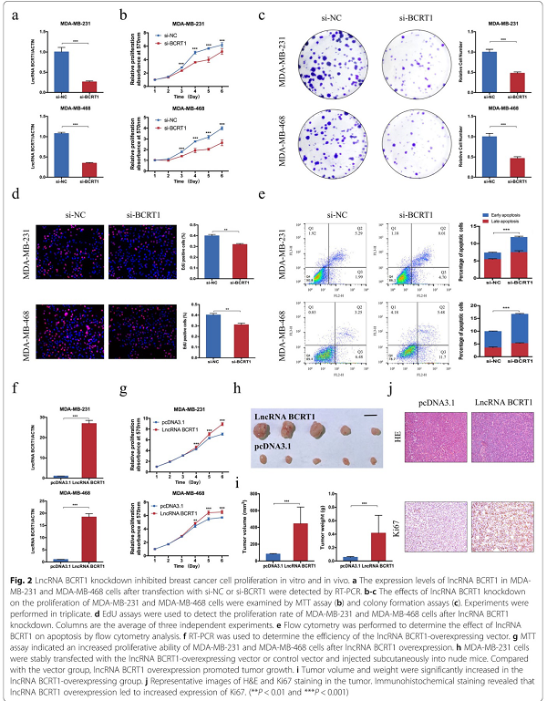 LncRNA BCRT1通过靶向miR-1303/PTBP3来促进乳腺癌的进展