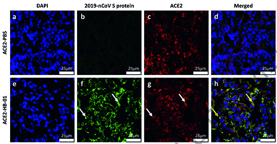 请看CNS是怎样使用义翘神州新冠蛋白的？
