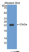 白介素12受体β1(IL2Rβ1）多克隆抗体