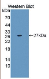 蛋白酶体亚基α7(PSMα7）多克隆抗体