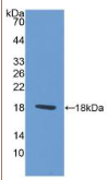 配对框基因6(PAX6）多克隆抗体