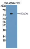 半胱氨酸共轭β裂解酶(CCβL1）多克隆抗体
