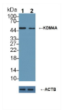 赖氨酸特异性去甲基化酶4A(KDM4A）多克隆抗体