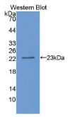 CD27结合蛋白(CD27BP）多克隆抗体