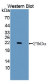 40kDa热休克蛋白2(HSPF2）多克隆抗体