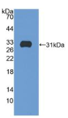 整合素β5(ITGβ5）多克隆抗体