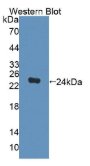 二肽酶2(DPEP2）多克隆抗体