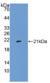 整合素α2B(ITGα2B）多克隆抗体