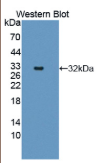 连环蛋白α1(CTNNα1）多克隆抗体