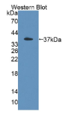 妊娠特异性β1-糖蛋白2(PSG2）多克隆抗体