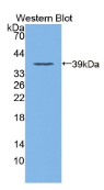 胞质分裂作用因子4(DOCK4）多克隆抗体