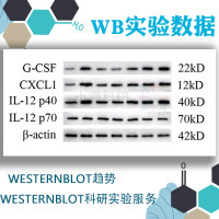 WB实验提供原始数据/western blot趋势/westernblot 科研实验服务