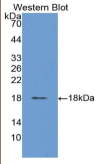 绒毛膜促性腺激素β肽(CGβ）多克隆抗体