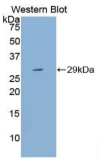 细胞色素P450家族成员21B(CYP21A2)多克隆抗体