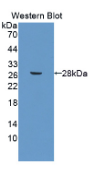 Ⅱ类主要组织相容性复合体DRβ1(MHCDRβ1）多克隆抗体