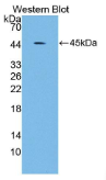 A类清道夫受体5(SCARA5）多克隆抗体