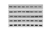 蛋白质免疫印迹(Western Blot,WB )实验
