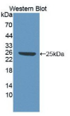 高迁移率族蛋白1(HMG1）单克隆抗体