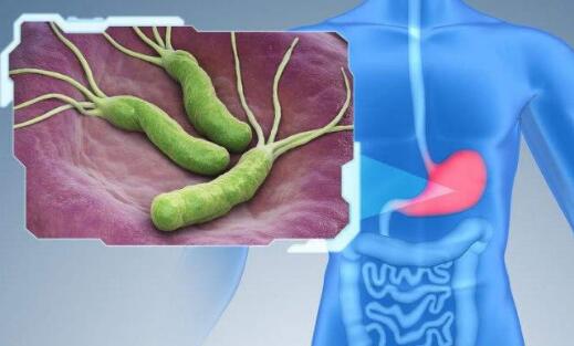 今天小编带大家了解“幽门螺旋杆菌”