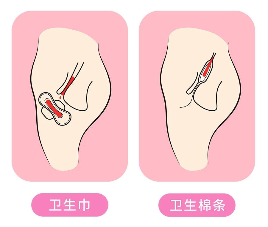 卫生棉条作为卫生巾的强势替代品,完全直击这些痛点,姨妈巾带来的这些