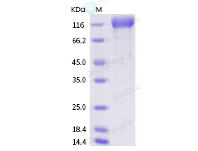 新冠病毒SARS-CoV-2 Spike S1重组蛋白