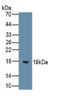 白介素9(IL9）单克隆抗体