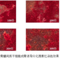 间充质干细胞(MSC)成骨诱导分化图/镜像绮点(Cellverse)