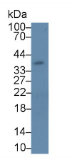 白介素1β(IL1β）单克隆抗体