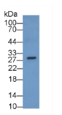 性别决定区Y框蛋白2(SOX2）单克隆抗体