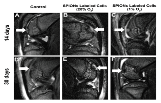 Ruskinn低氧工作站细胞领域研究——磁共振成像（MRI）示踪低氧预处理骨髓间充质干细胞修复关节软骨损伤的研究
