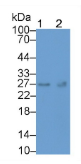 可溶性胸苷激酶1(TK1）单克隆抗体