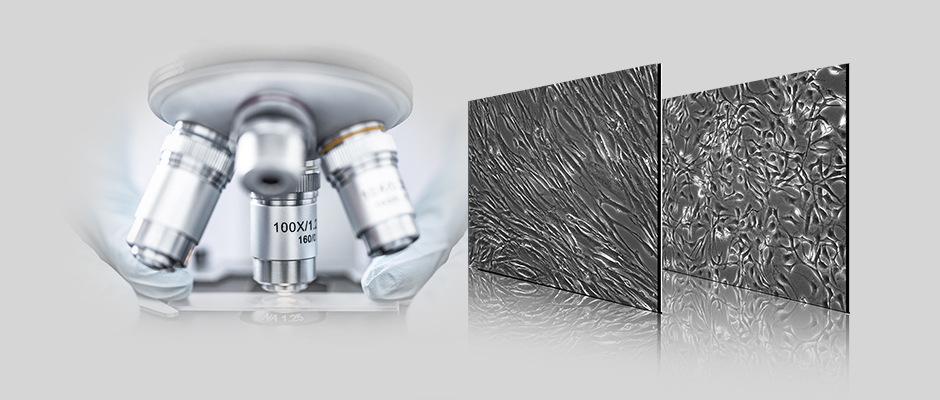 间充质干细胞- 最有希望进入临床应用阶段的种子细胞