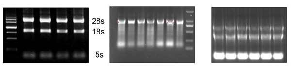 PCR疑难问题粉碎机（三）——逆转录PCR