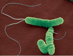 Baker Ruskinn厌氧工作站微生物厌氧领域研究——消化道微生物幽门螺杆菌