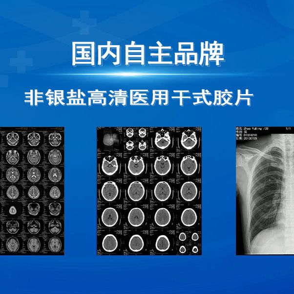医用干式胶片特价供应